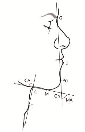 Measured distances and angles. Distance from the Gonion-gnathion (Gn)... | Download Scientific ...