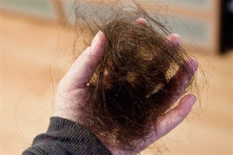 Post-Partum Hair Loss | | Geek in Heels