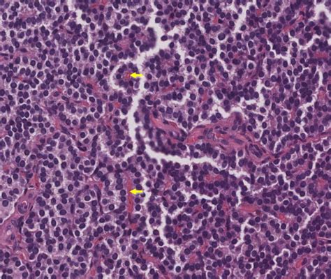 Parathyroid glands – Veterinary Histology