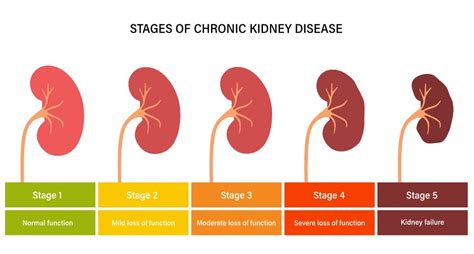 GFNC on Kidney Disease - Grenadian Voice