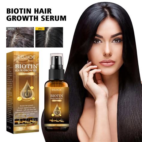 Biotin Hair Growth Spray, Fast Growing Hair Care, Essential Oil, Skin Nursing, Topical Scalp ...