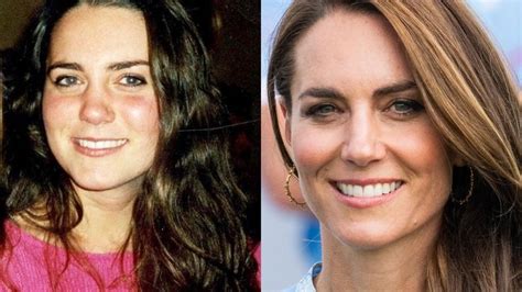 Kate Middleton plastic surgery: How many has the Princess had ...