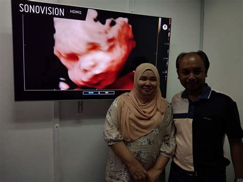 Sonobeeultrasound | Shah Alam