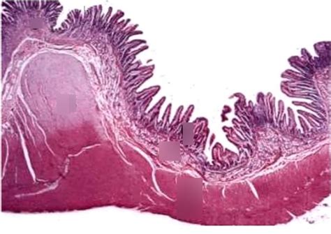 Histology- Pyloric Sphincter Diagram | Quizlet