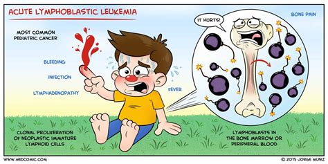 Causes Of Acute Lymphoblastic Leukemia In Childhood