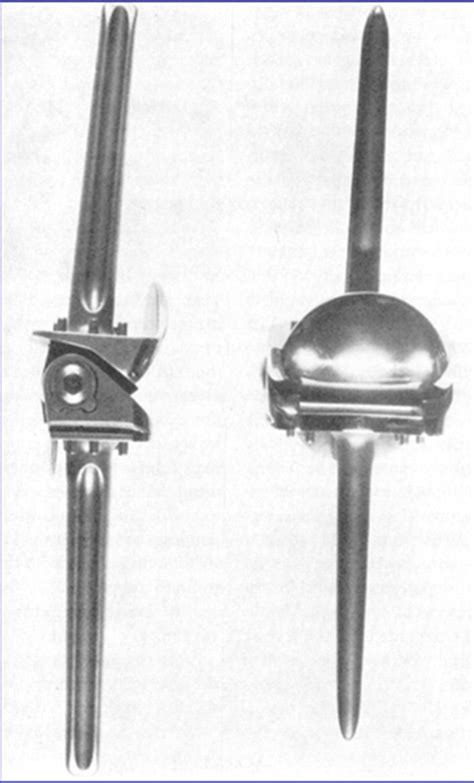 TKA Prosthesis Design - Recon - Orthobullets