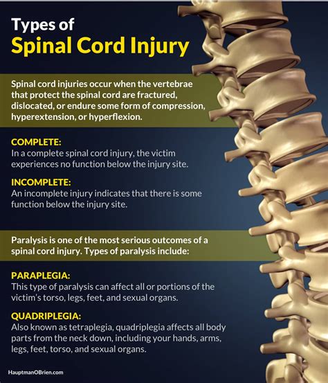 Spinal Cord Injury Lawyers - Sarpy County Injury Law Firm