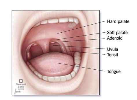 Adenoidectomy (Adenoid Removal): Surgery & Recovery