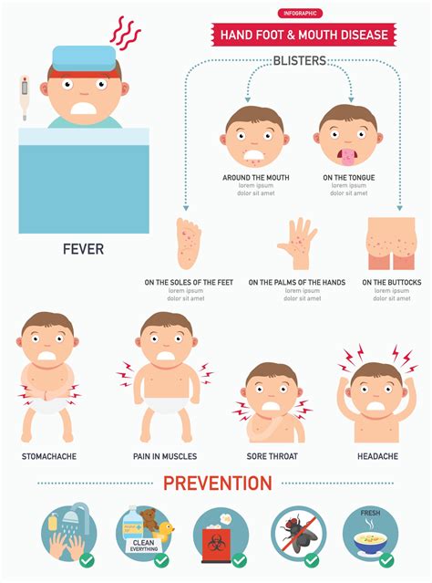 Hand,foot and mouth disease infographic 3203904 Vector Art at Vecteezy