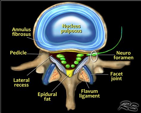 Herniated Disc Lumbar Spine Anatomy | Images and Photos finder