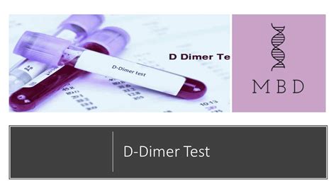 D-dimer test - My Biology Dictionary