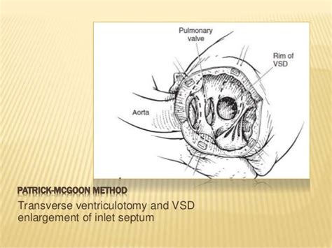 Dorv surgery