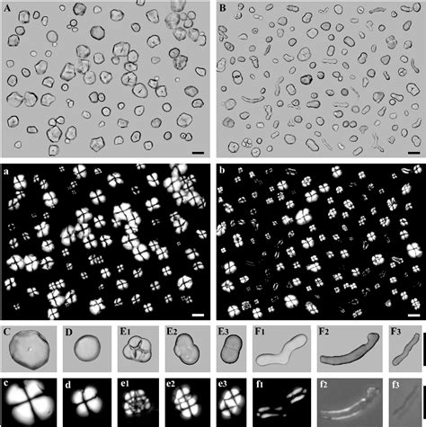 Figure 4 from Morphology, structure and gelatinization properties of heterogeneous starch ...