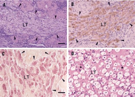 Remnants of luteal tissue (LT) at advanced corpus luteum (CL)... | Download Scientific Diagram