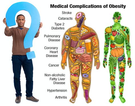 Obesity Archives » Laboratory Testing and Research