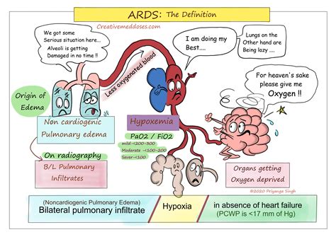 Ards : The causes of acute respiratory distress syndrome (ards) are not ...