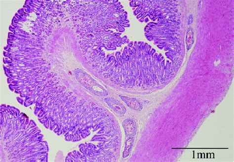 Several cysts in cane toad submucosa containing Physocephalus species A ...