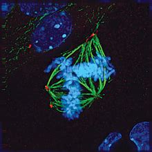 Do Centrosome Abnormalities Lead to Cancer? | Science