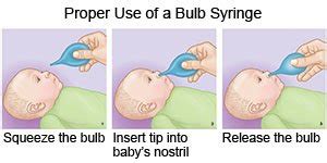 How To Use A Bulb Syringe - What You Need to Know