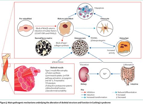 [PDF] Complications of Cushing's syndrome: state of the art. | Semantic ...