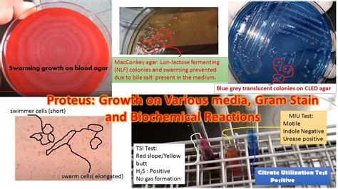 Proteus: General Characteristics, Morphology, Pathogenecity, Laboratory