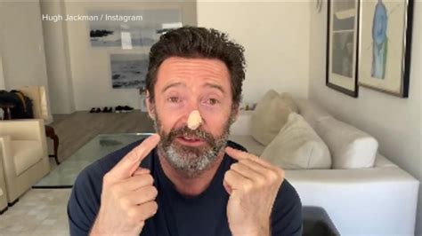 Video Hugh Jackman reveals results of skin cancer biopsies - ABC News