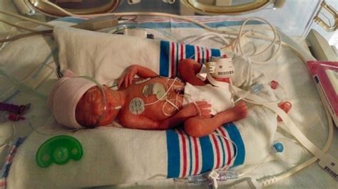 Preemie born 29 weeks | BabyCenter