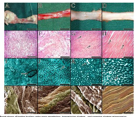 Figure 3 from Tendon and Ligament Tissue Engineering, Healing and Regenerative Medicine ...