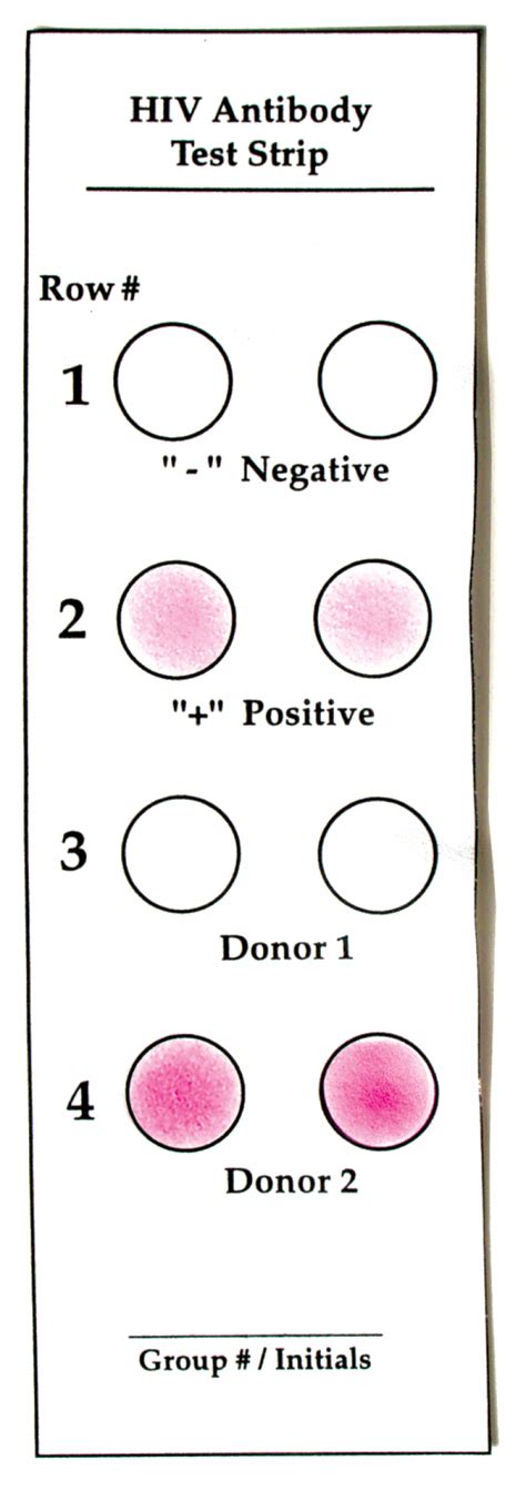 How Does a Doctor Test for AIDS? » BioTek