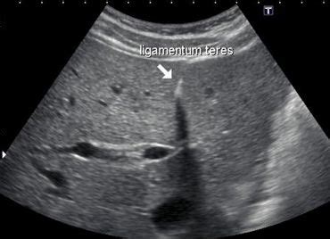 ultrasound of liver segments anatomy | Ultrasound, Medical ultrasound, Diagnostic medical sonography