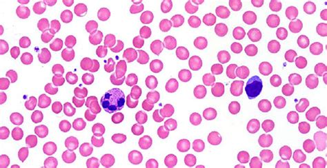 Essential Human Biology : Cells & Tissues : Connective Tissue