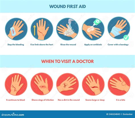 Aid Skin Wound. First Aids Stop Bleeding, Infographic Types Emergency Treatment Damaged Hands ...