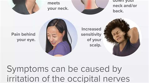 What Is Occipital Neuralgia? Symptoms, Causes And Treatment, 40% OFF