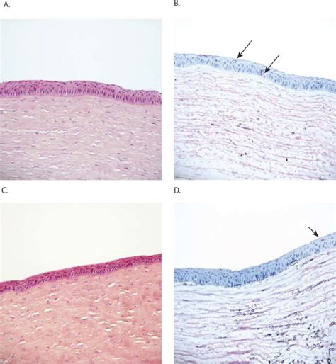 Corneal epithelium. Cytologic features of (A) a cornea after... | Download Scientific Diagram