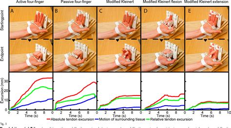 [PDF] Ultrasonographic assessment of flexor tendon mobilization: effect of different protocols ...