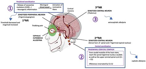 Frontiers | Cutaneous Allodynia in Migraine: A Narrative Review