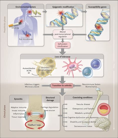 The Pathogenesis of Rheumatoid Arthritis | NEJM