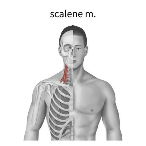 Scalene Trigger Points: Causes, Symptoms, and Treatment Options - Trigger Point Secrets