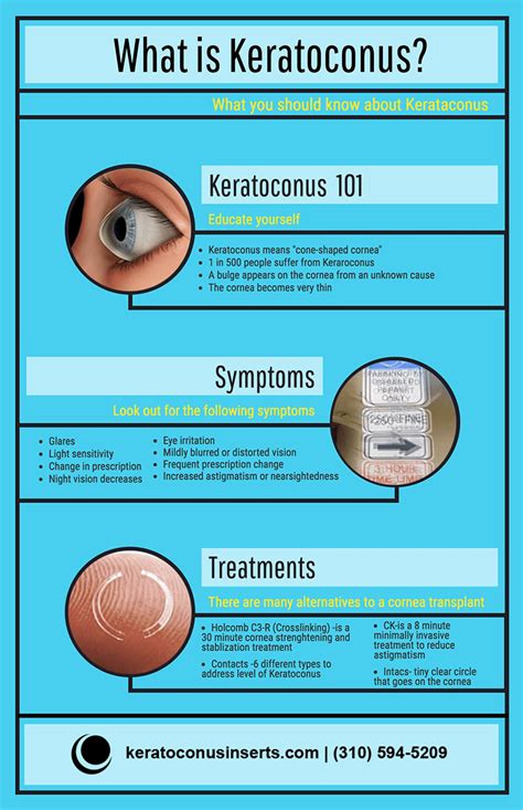 Cure for Keratoconus - Keratoconus Infographic