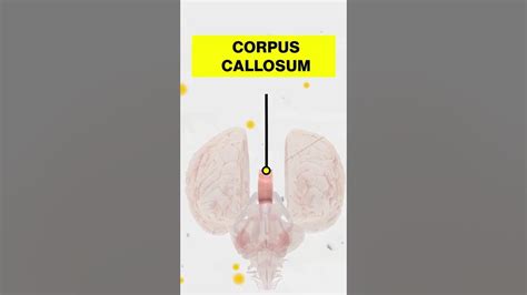 Apa itu Corpus Callosum? | Split Brain Syndrome - YouTube