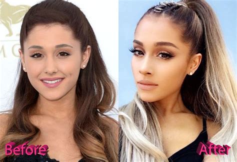 Ariana Grande Plastic Surgery: True or Just Rumours?