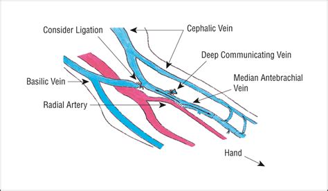 Superficial Veins of Forearm : Mnemonic | Epomedicine