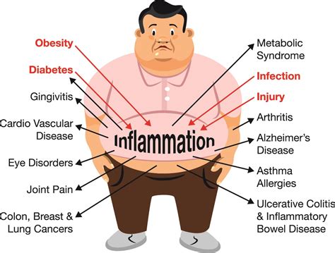 Inflammation: Disease Begins in Your Gut? – Naked Biotics