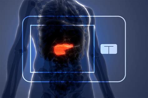 FDA Approves UVA-Developed Artificial Pancreas | UVA Today