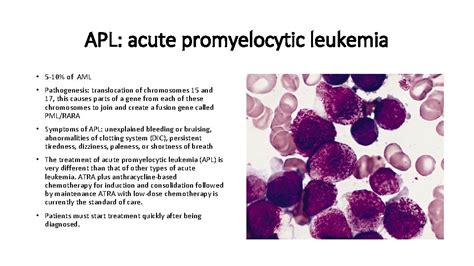 Acute myeloid leukemia AML Justyna Rybka Department of