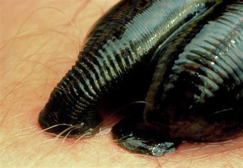 Medicinal Leech Sucking Blood From Human Arm Photograph by Martin Dohrn ...