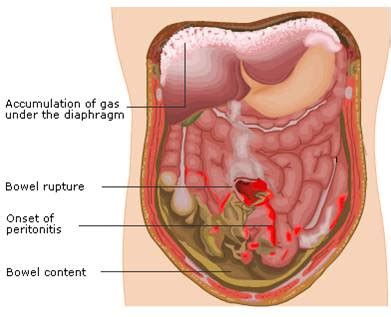 Other Organs – RCEMLearning India