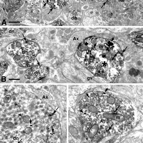 Cell bodies of neurosecretory neurones of the supraoptic nucleus... | Download Scientific Diagram