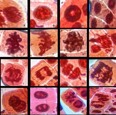 Chromosome abnormalities in the various phases of mitotic cell division... | Download Scientific ...