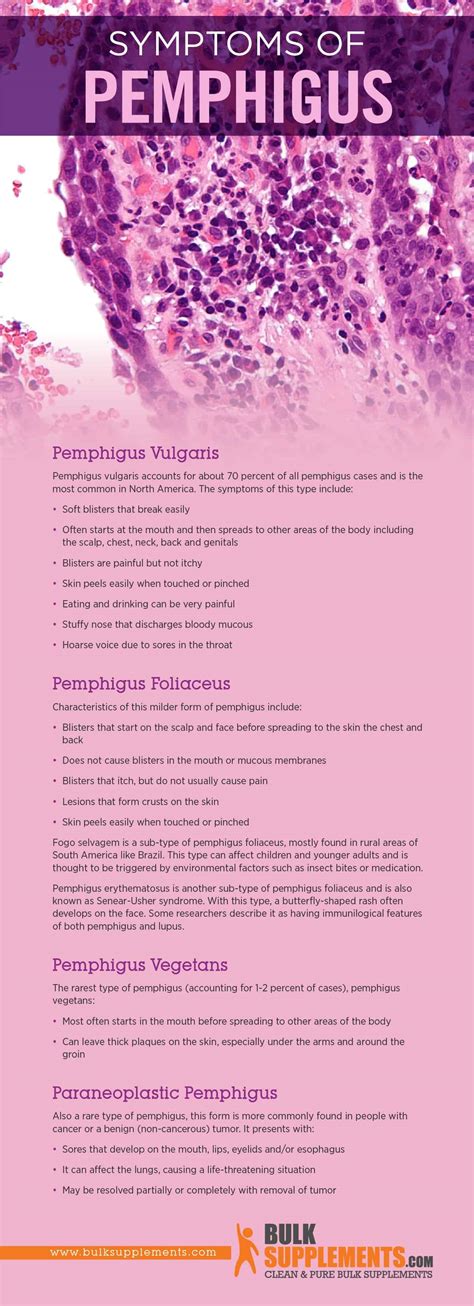 Pemphigus: Symptoms, Causes & Treatment